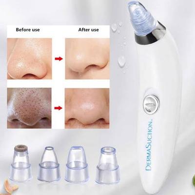 Derma suction pore cleaner
